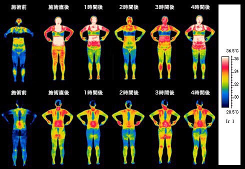 インディバの効果とは？